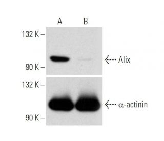 Alix CRISPR/Cas9 KO Plasmid (h): sc-400350. Western blot analysis of human Alix expression in empty vector control (A) and 