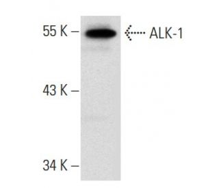 western blotting image from recommended ALK-1 (RM0015-1B03) monoclonal antibody replacement. Image 34831