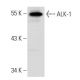 western blotting image from recommended ALK-1 (RM0015-1B03) monoclonal antibody replacement. Image 34831