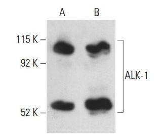 ALK-1 Antibody (E-11) - Western Blotting - Image 398505 