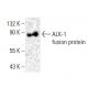ALK-1 Antibody (E-11) - Western Blotting - Image 398504