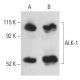 ALK-1 Antibody (E-11) - Western Blotting - Image 398505 