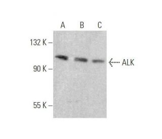 ALK Antibody (ALK1) - Western Blotting - Image 353287 