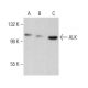 ALK Antibody (ALK1) - Western Blotting - Image 377222