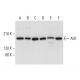 This polyclonal antibody has been discontinued. See our recommended <a href="alk-antibody-f-12">ALK (F-12)</a> monoclonal antibody (sample data shown). western blotting image from recommended ALK (F-12) monoclonal antibody replacement. Image 308430