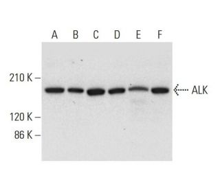 ALK Antibody (F-12) - Western Blotting - Image 308430