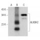 ALKBH2 Antibody (C-9) - Western Blotting - Image 364828 