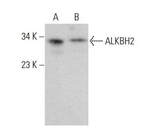 ALKBH2 Antibody (C-9) - Western Blotting - Image 379805SAM Transcription Activation: SAM system utilizing dCas9-VP64, MS2-P65-HSF1, and sgRNA for precise gene transcription activation.