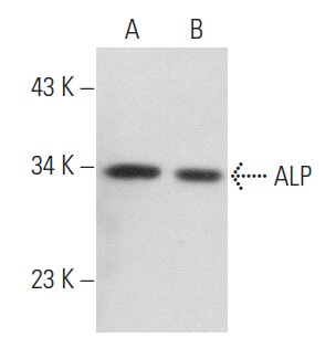 alp様 AX-437 C.62 - MonkeyFlipRubeR - 名古屋・大須のオシャレな眼鏡