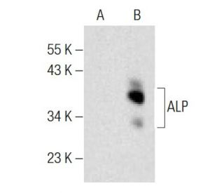 ALP Antibody (C-8) - Western Blotting - Image 146561 
