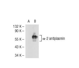 &alpha;-2 antiplasmin Antibody (JJ-16) - Western Blotting - Image 53607 