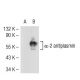 α-2 antiplasmin Antibody (JJ-16) - Western Blotting - Image 53607 