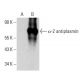 α-2 antiplasmin Antibody (MAP25C3) - Western Blotting - Image 364787