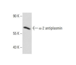 &alpha;-2 antiplasmin Antibody (SJ-19) - Western Blotting - Image 61812 