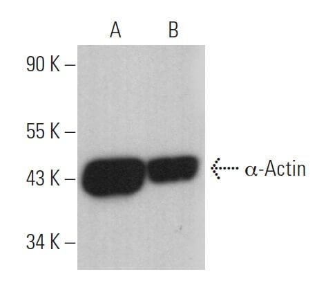 Actin Antibody 0.N.5 SCBT Santa Cruz Biotechnology