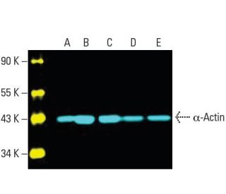 &alpha;-Actin Antibody (1A4) - Western Blotting - Image 396211 
