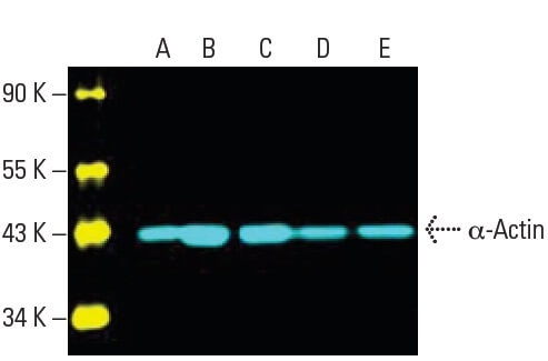 α-Actin Antibody (1A4) | SCBT - Santa Cruz Biotechnology