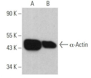 &alpha;-Actin Antibody (a-SM1) - Western Blotting - Image 360928 