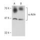 α-Actin Antibody (Alpha Sr-1) - Western Blotting - Image 148670 