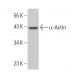 α-Actin Antibody (Alpha Sr-1) - Western Blotting - Image 376167