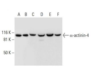 α-actinin-4 Antibody (A-8) - Western Blotting - Image 295985