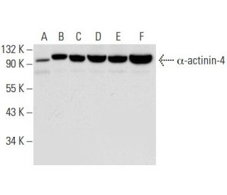 &alpha;-actinin-4 Antibody (D-3) - Western Blotting - Image 301285 