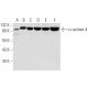 α-actinin-4 Antibody (D-3) - Western Blotting - Image 301285 