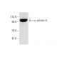 α-actinin-4 Antibody (D-3) - Western Blotting - Image 301286