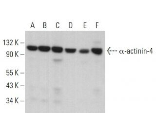 western blotting image from recommended &alpha;-actinin-4 (G-4) monoclonal antibody replacement. Image 380776