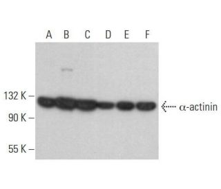 &alpha;-actinin Antibody (B-12) - Western Blotting - Image 353255 