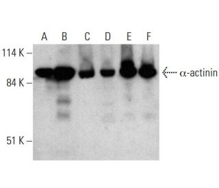 &alpha;-actinin Antibody (H-2) - Western Blotting - Image 384018 