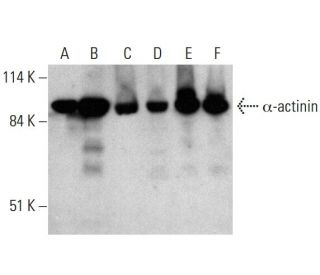 western blotting image from recommended &alpha;-actinin (H-2) monoclonal antibody replacement. Image 384018