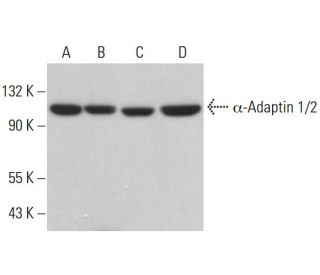 western blotting image from recommended &alpha;-Adaptin 1/2 (C-8) monoclonal antibody replacement. Image 380871