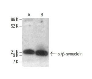 western blotting image from recommended alpha/beta Synuclein (Syn 202) monoclonal antibody replacement. Image 350708