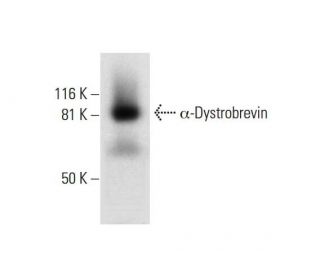 &alpha;-Dystrobrevin Antibody (D-9) - Western Blotting - Image 294836 