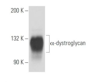 &alpha;-dystroglycan Antibody (2237E2D1) - Western Blotting - Image 15779