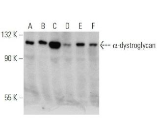 &alpha;-dystroglycan Antibody (D-3) - Western Blotting - Image 356172 
