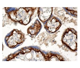 immunohistochemistry image from recommended &alpha;-dystroglycan (IIH6) monoclonal antibody replacement. Image 156885
