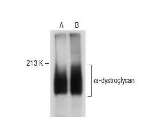 &alpha;-dystroglycan Antibody (IIH6C4) - Western Blotting - Image 149590