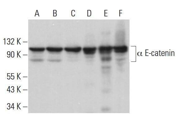Anti A E Catenin Antibody G 11 Scbt Santa Cruz Biotechnology