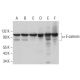western blotting image from recommended α E-catenin (G-11) monoclonal antibody replacement. Image 380897