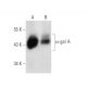α-gal A Antibody (C6) - Western Blotting - Image 374581