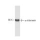α-internexin Antibody (2E3) - Western Blotting - Image 67333
