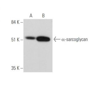 &alpha;-sarcoglycan Antibody (C-12) - Western Blotting - Image 344630