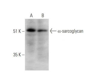 &alpha;-sarcoglycan Antibody (G-11) - Western Blotting - Image 344723 