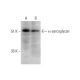 α-sarcoglycan Antibody (G-11) - Western Blotting - Image 344723 