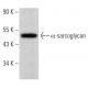 α-sarcoglycan Antibody (G-11) - Western Blotting - Image 364276
