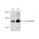 This polyclonal antibody has been discontinued. See our recommended <a href="alpha-syntrophin-antibody-d-7">α-Syntrophin (D-7)</a> monoclonal antibody (sample data shown). western blotting image from recommended α-Syntrophin (D-7) monoclonal antibody replacement. Image 72338