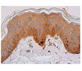 alpha Synuclein Antibody (211) - Immunohistochemistry - Image 350532 