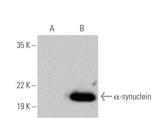 alpha Synuclein抗体(211) | SCBT - Santa Cruz Biotechnology